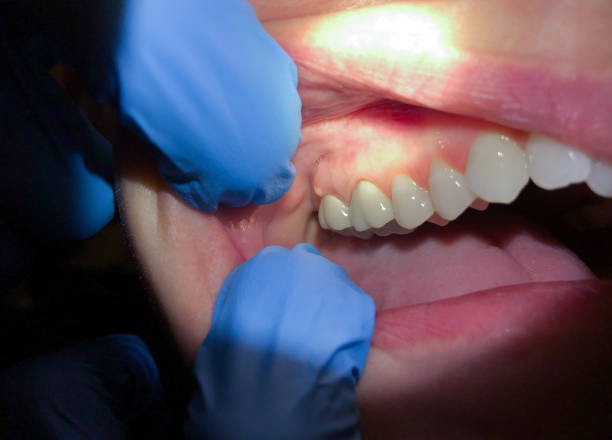 Best Same-Day Emergency Dentist in Kingston Springs, TN